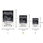 Puzzle photo personnalisé avec photo et textes - Cadeau de la fête des Mères pour les futures mamans